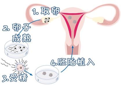 爱心拉拉代怀咨询怎么选
